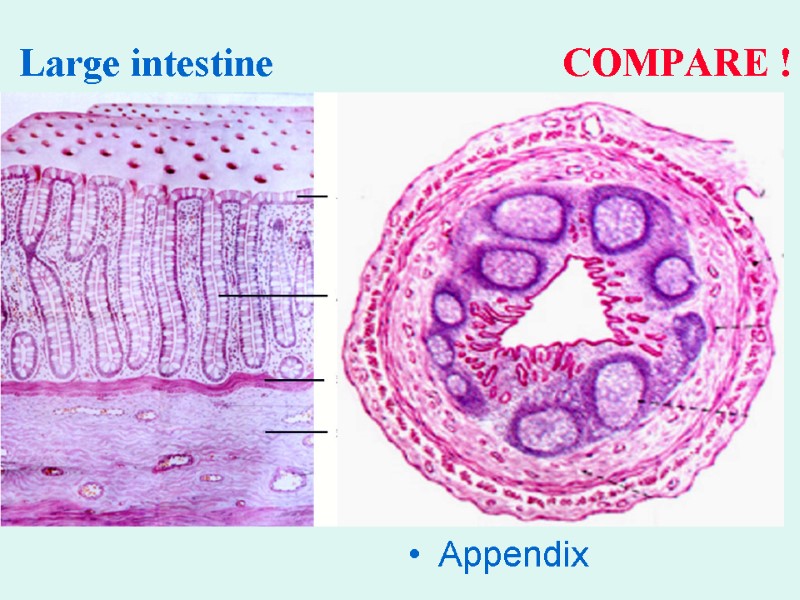 Large intestine    COMPARE ! Appendix